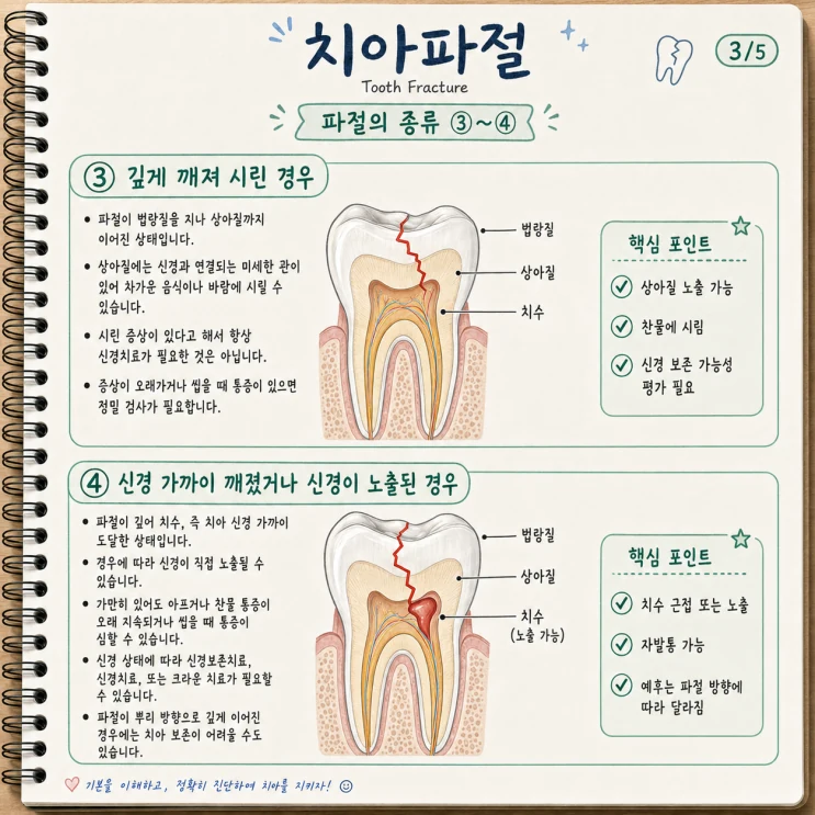 치아파절 신경 상태 확인 이미지