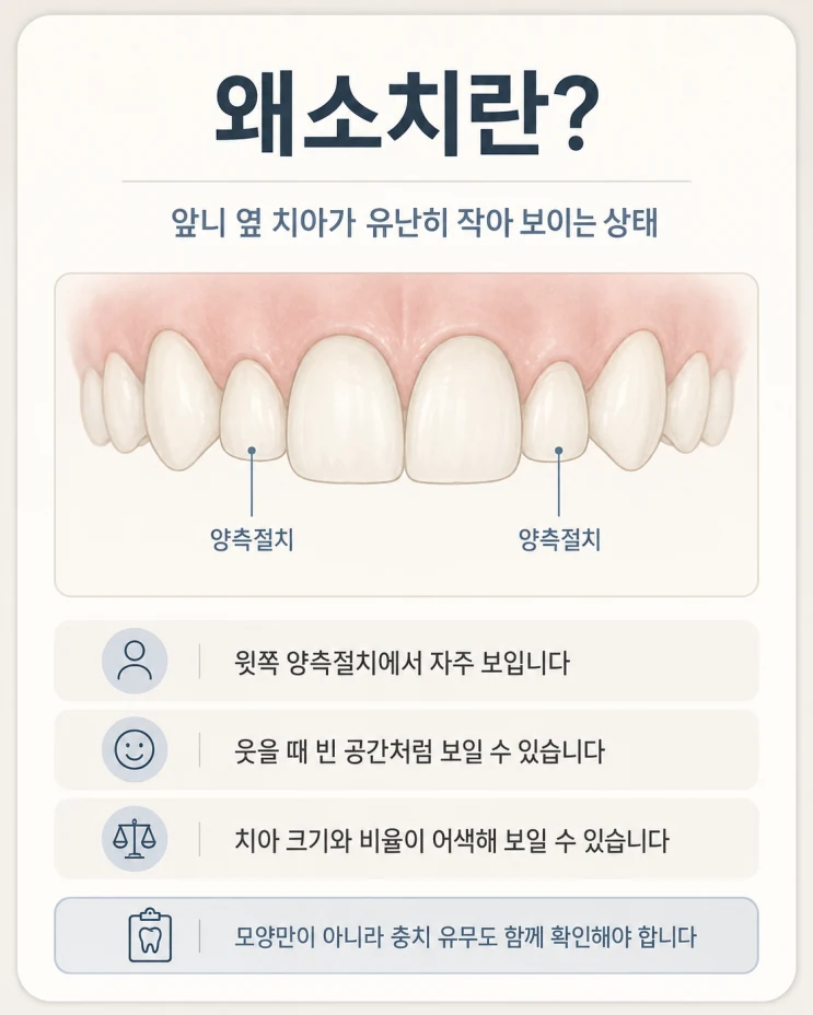 치아가 작아요, 왜소치 치료법 수원치과에서 라미네이트로 치료
