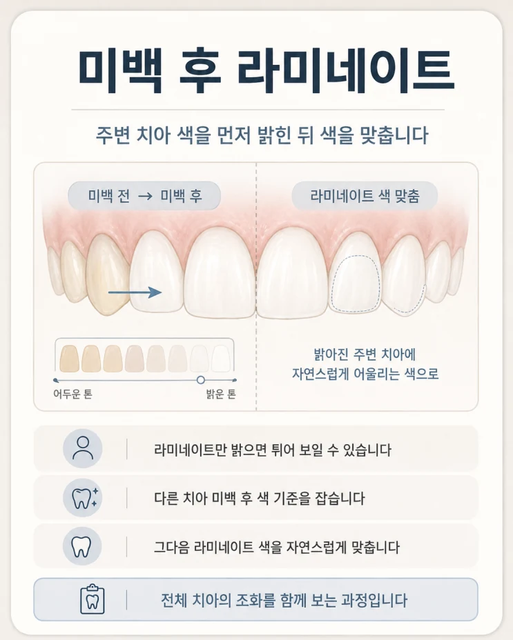 치아가 작아요, 왜소치 치료법 수원치과에서 라미네이트로 치료