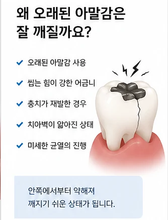 레진 빌드업, 아말감교체 레진으로 가능한가요?