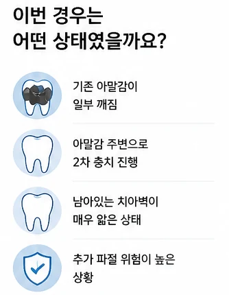 레진 빌드업, 아말감교체 레진으로 가능한가요?