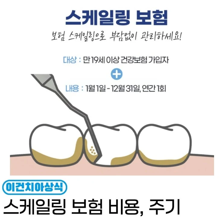 스케일링 건강보험 적용 안내 이미지