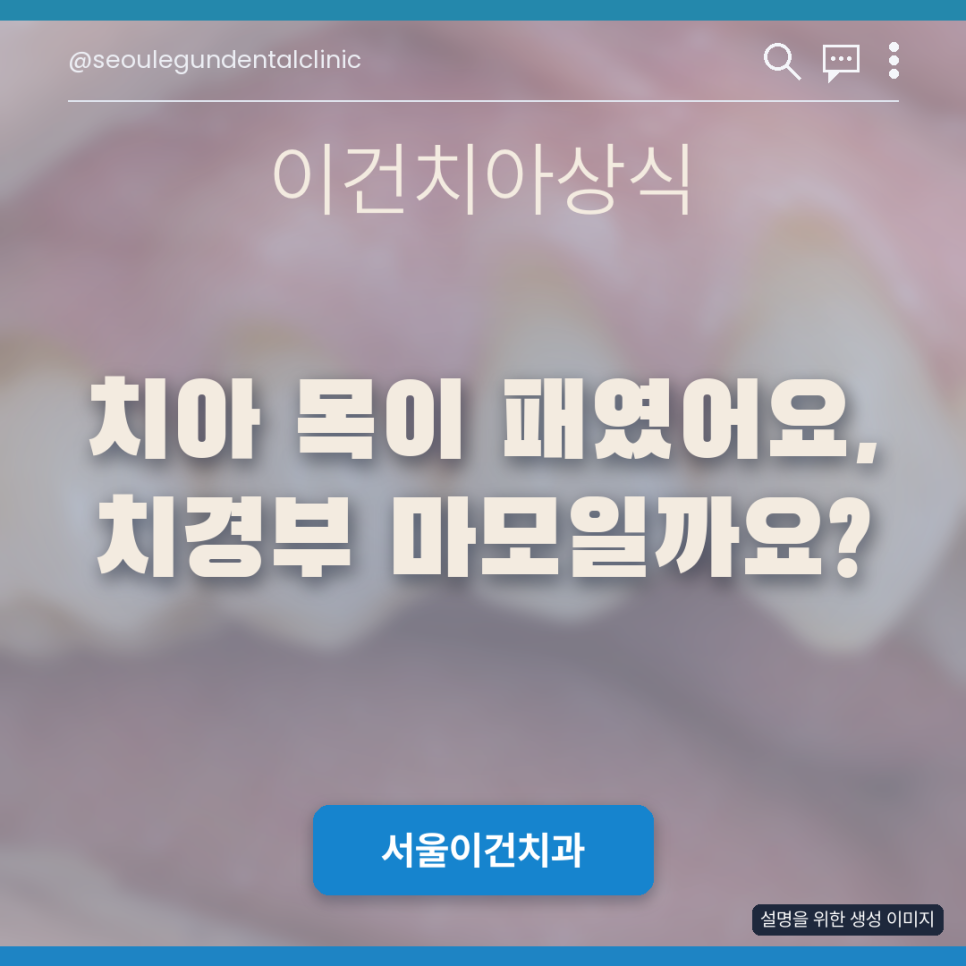 수원치과 | 치아 잇몸 쪽이 패였어요, 치경부 마모증일까요?